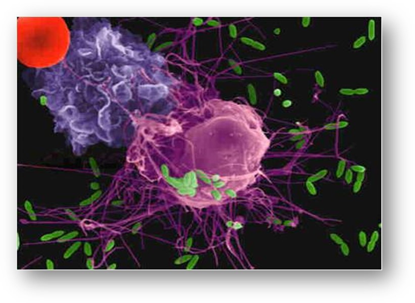 Management of Perinatal Sepsis, Septic Shock and Toxic Shock Syndrome Banner